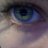 Blauauge